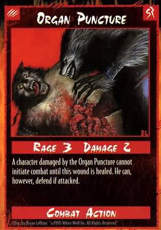 Organ Puncture Unlimited Organ Puncture Unlimited